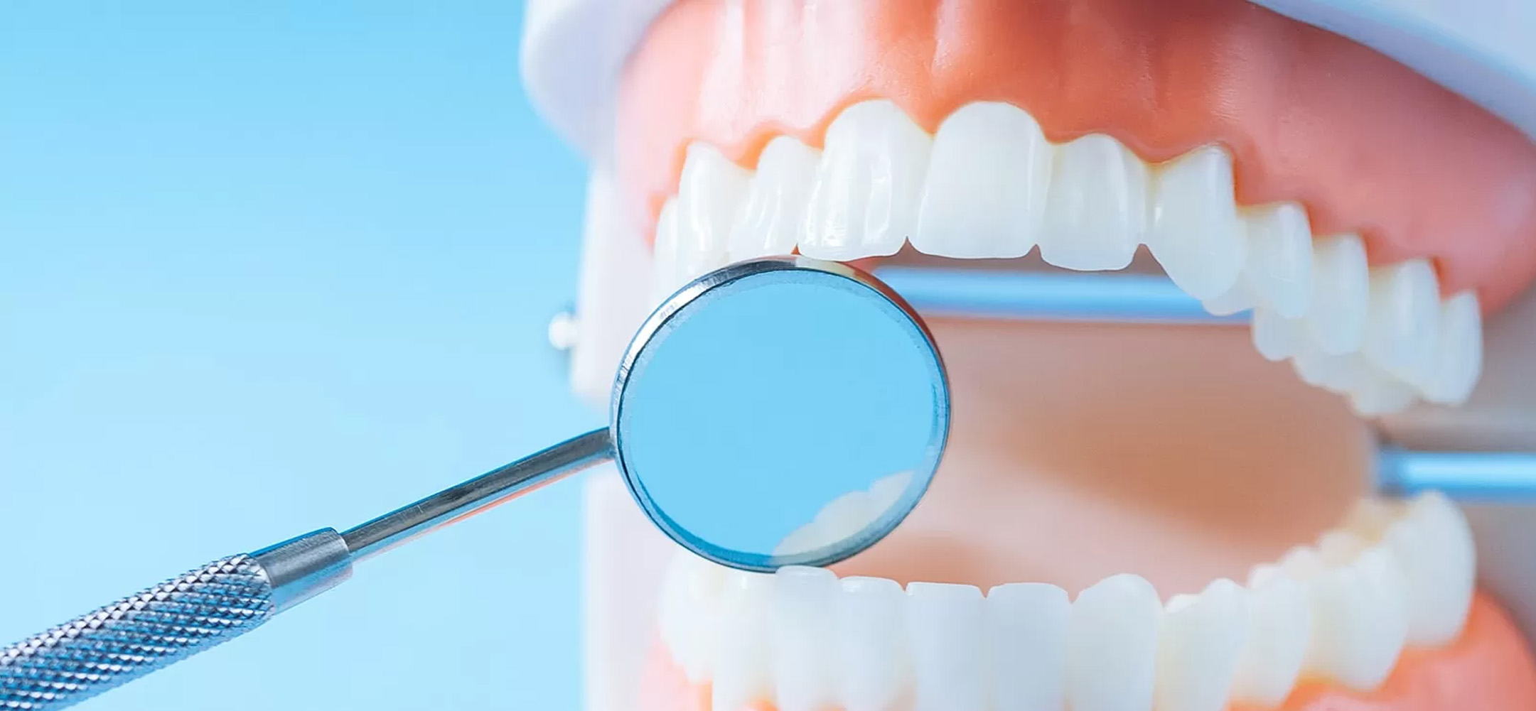 予防歯科／定期検診・歯のクリーニングについて